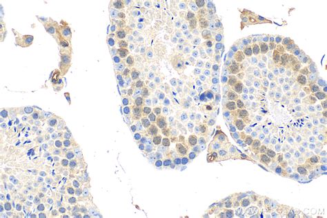 Ube S Antibody Rr Proteintech