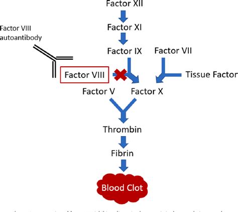 Figure From Acquired Factor Viii Inhibitor Caused By Solid Tumor