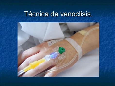 2011 3 Via Endovenosa Venoclisis