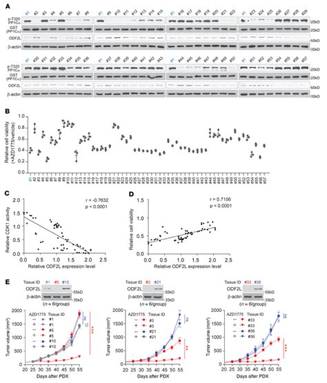 Odf L Expression Levels Are Clinically Relevant To Azd Sensitivity