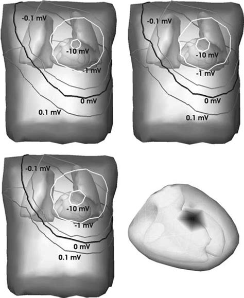 Computed Body Surface Potentials Using Three Different Numerical