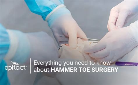 Hammer toe surgery: condition, procedures, recovery