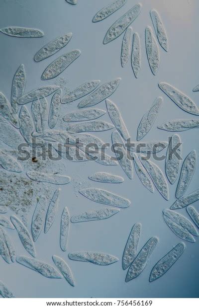 Ciliates Under Microscope Stock Photo 756456169 | Shutterstock