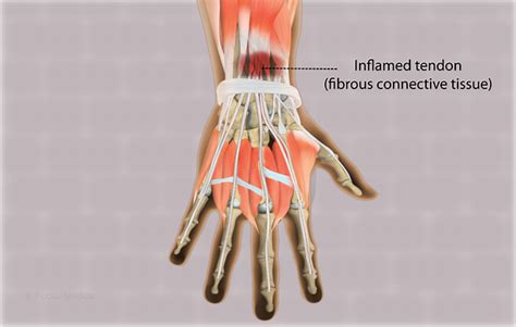 Health Condition : Symptoms, Causes, Treatment and More