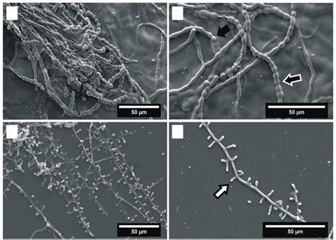 Scanning electron microscopic image showing micromorphological ... 