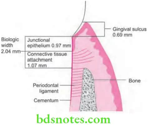 Restorative Periodontal Inter relationships Question And Answers - BDS ...