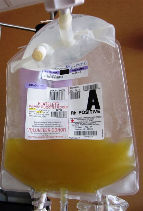 Jm S Adventure With Multiple Myeloma Day 9 Platelet Transfusion