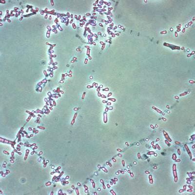 Fungal foot infections risk secondary infection in diabetic patients ...