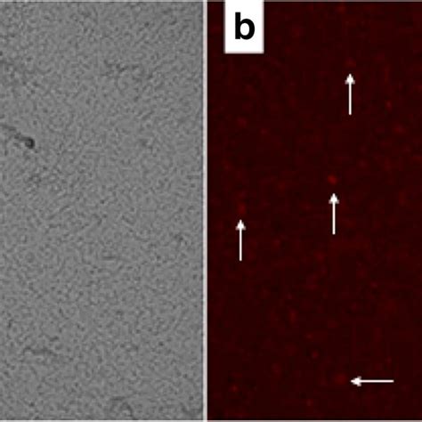 Brightfield A And Red Fluorescence B Microscopy Images Of A A