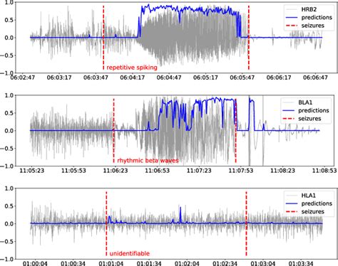 Figure From Early Seizure Detection With An Energy Efficient