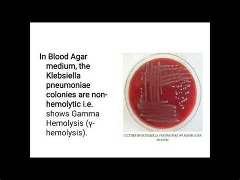 Culture Characteristics Of Klebsiella Spp By J Mary Pohsnem Dept Of