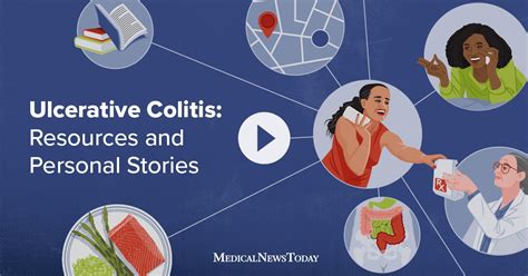 Guides And Personal Experiences About Ulcerative Colitis