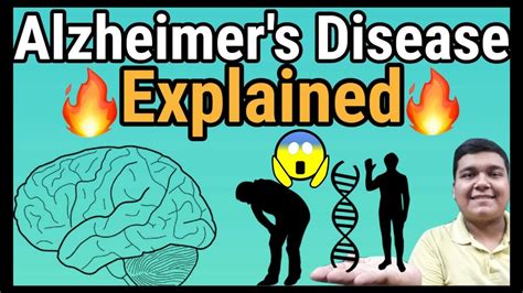 Alzheimers Disease Explained How It Is Caused Youtube