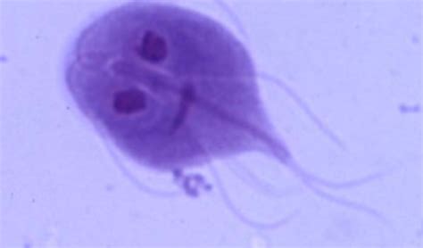 Giardiasis Giardia Infection Causes Symptoms And Treatment