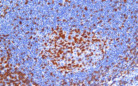 Zap Antibody Rabbit Monoclonal Antibody Mab Ihc Buy Now