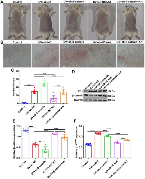 Artesunate Treatment Ameliorates Ultraviolet Irradiation Driven Skin Photoaging Via Increasing β