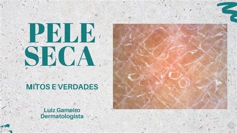 Pele Seca Mitos E Verdades Luiz Gameiro Dermatologista Youtube