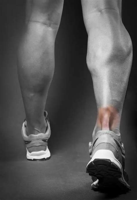 Achilles Tendonitis Symptoms And Treatment Help My Foot Pain