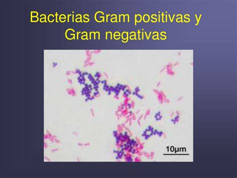 Pared celular bacteriana