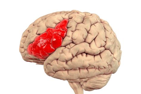 Broca’s Area of the Brain: Function and Location