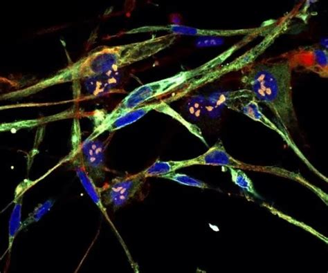 Notícias Cientistas transformam células de um câncer infantil em