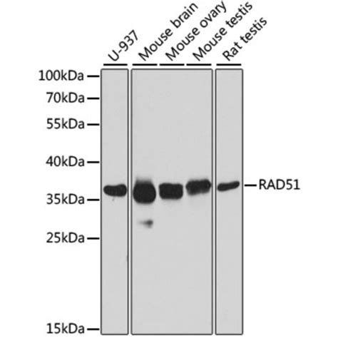 Anti-RAD51 Antibody (A15139) | Antibodies.com