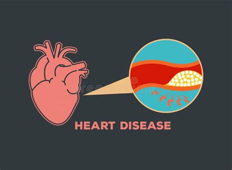 Heart Disease Logo Vector Icon Stock Vector Illustration Of Medicine