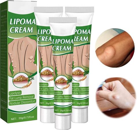 LipomaCure Soothing Ointment Lumpfree Lipoma Removal Cream Skin Anti