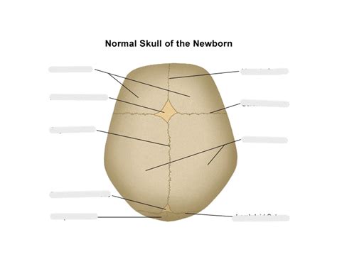 Cranial Sutures Quiz