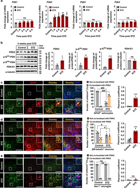 Expression Of Pdk And Phosphorylated Pdh In Mouse Hypothalamus Download Scientific Diagram