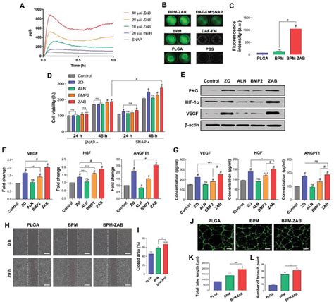 Zab Promotes Angiogenesis With No Release A No Release Profiles With