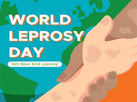 World Leprosy Day 2024 Date - Ami Lindsay