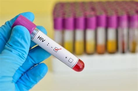 Third Person Cured Of HIV After Stem Cell Transplant Study Says News24