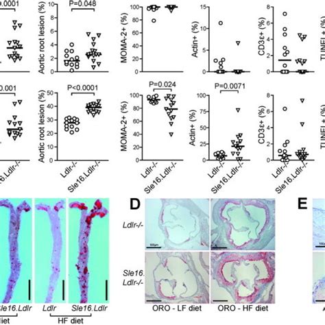 Accelerated Atherosclerosis In Sle16 Ldlr Mice Compared To Ldlr