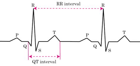 Electrocardiography Ecg Of A Heart In Normal Sinus Rhythm Although