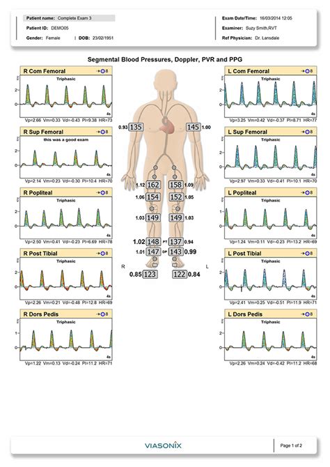 Physiological Vascular Testing Is A Standard Reimbursable Procedure