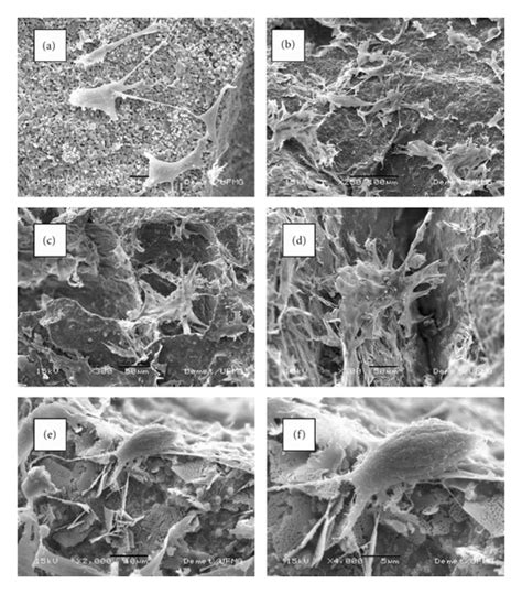 Sem Micrographs Of The Morphology Of Osteoblast Cultured On Liha Matrix