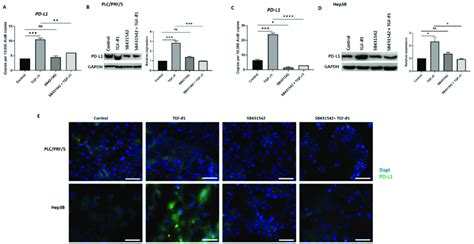 Sb Inhibits Tgf Induced Expression Of Pd L In Hcc Cells A