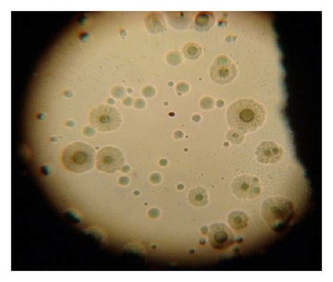 mycoplasma colonies  fried egg appearance  scientific