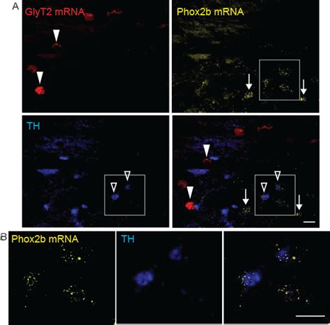 Combining Multiplex Fluorescence In Situ Hybridization With Fluorescent