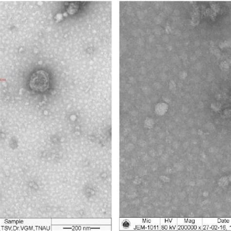 Transmission Electron Microscopic Image Of TSV Infecting Cotton