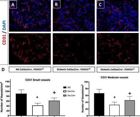 Frontiers Foxo Deletion In Chondrocytes Rescues Diabetes Impaired