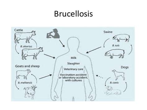 Brucellosis Exploring Microbial Diseases