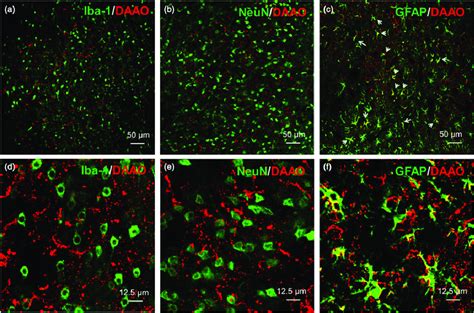 Double Immunofluorescent Staining Of D Amino Acid Oxidase Daao With