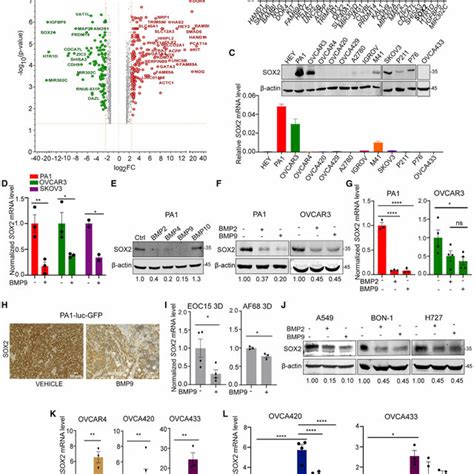 Sox Is Downregulated By Bmp And In Cancer Cell Lines And