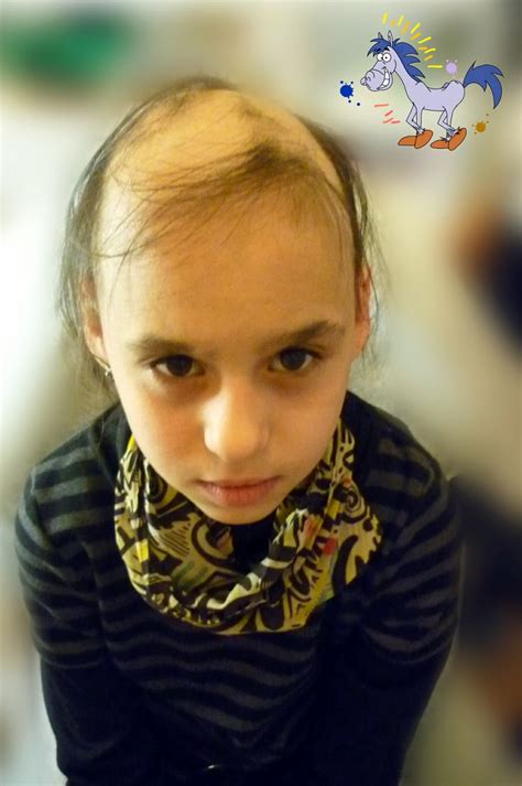 Pin on Children Hair Loss, Alopecia Areata, Alopecia Totalis, and ...