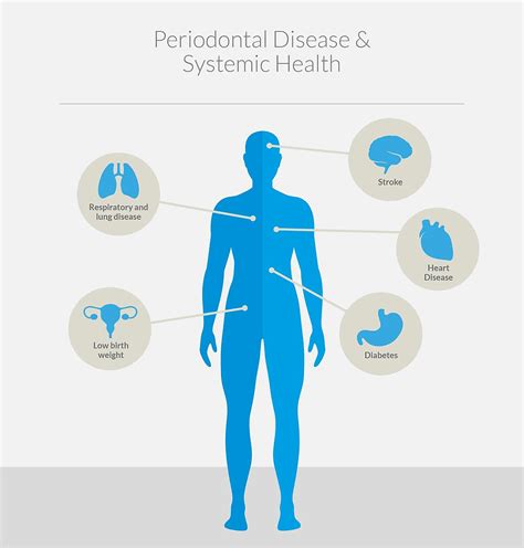 Periodontal Links To Systemic Disease