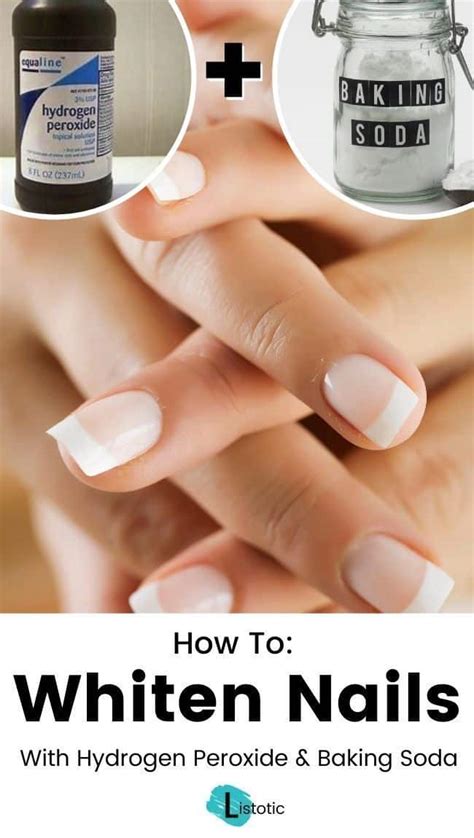 Best Ways To Whiten Your Nails So Easy And They Actually Work