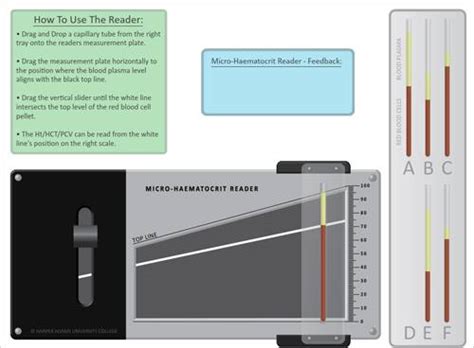 Microhematocrit Reader