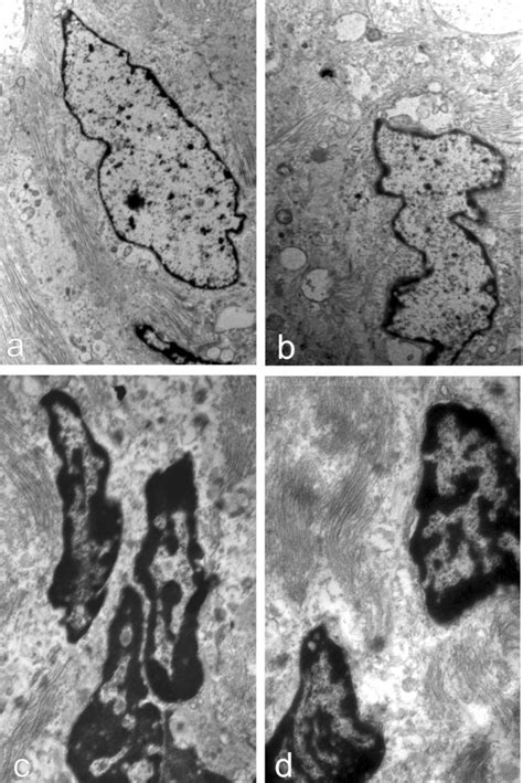 The Nuclei Ultrastructure In A B Eutopic And C D Ectopic Download Scientific Diagram